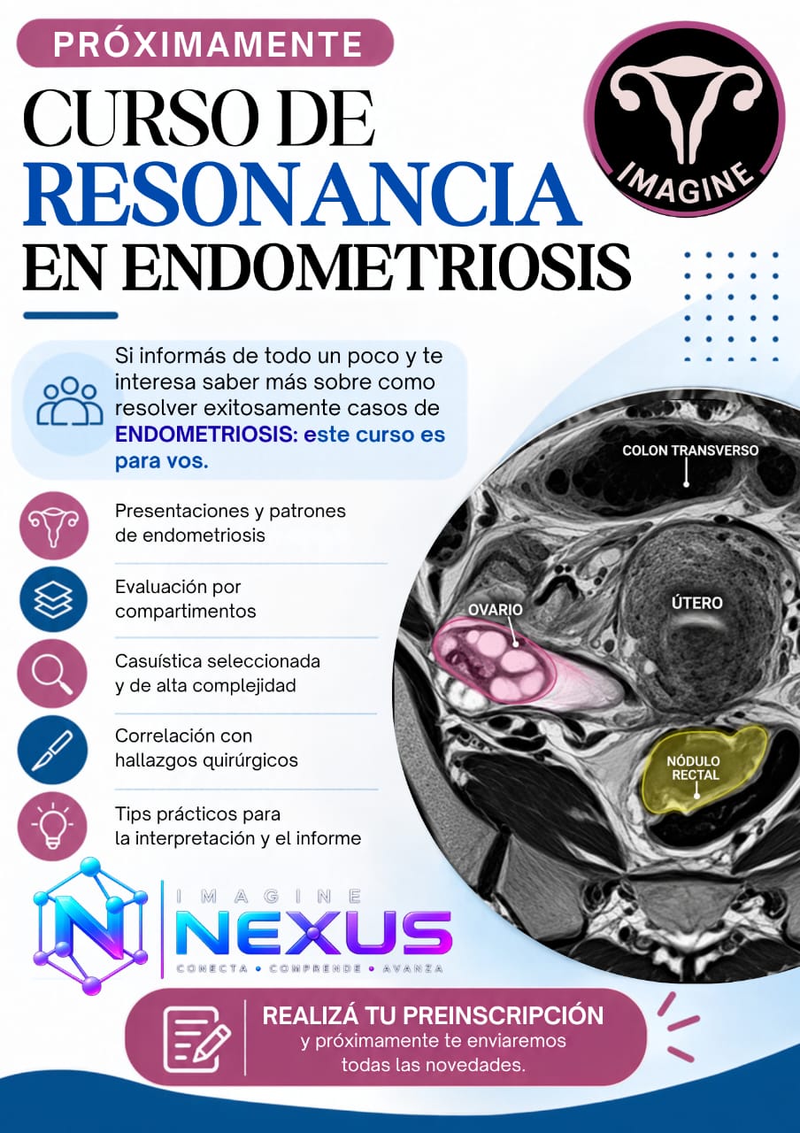 Portada de RESONANCIA EN ENDOMETRIOSIS